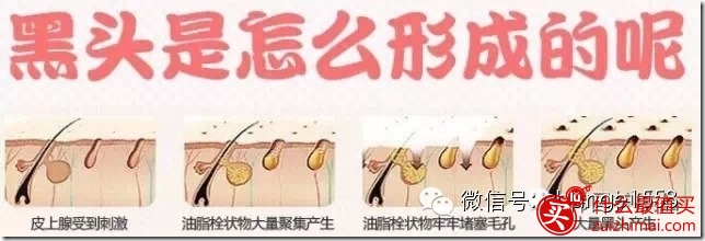 韩国可莱丝猪鼻子贴 去黑头粉刺猪鼻贴三部曲 使用方法-图片8